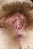 ATK hairy  in young and hairy