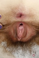 ATK hairy  in young and hairy