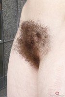 ATK hairy  in young and hairy