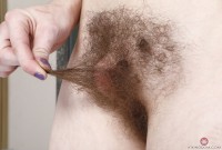 ATK hairy  in young and hairy