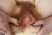 ATK hairy  in young and hairy
