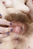 ATK hairy  in young and hairy