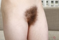 ATK hairy  in young and hairy