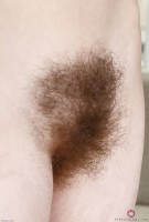 ATK hairy  in young and hairy
