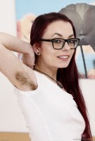 ATK hairy  in young and hairy