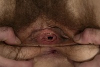 ATK hairy  in young and hairy