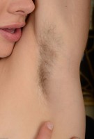 ATK hairy  in young and hairy
