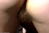 ATK hairy  in mature and hairy
