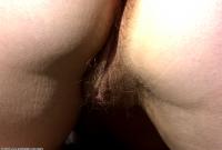 ATK hairy  in mature and hairy