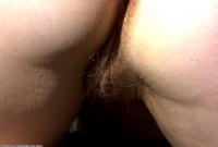 ATK hairy  in mature and hairy