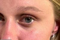 ATK hairy Jacque Set