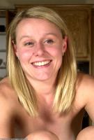 ATK hairy  in mature and hairy