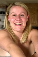 ATK hairy  in mature and hairy