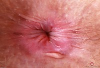 ATK hairy Jackie Hoff Set