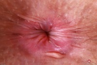 ATK hairy Jackie Hoff Set