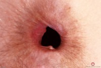 ATK hairy Jackie Hoff Set