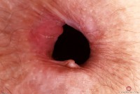 ATK hairy Jackie Hoff Set