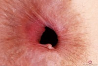 ATK hairy Jackie Hoff Set