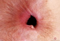 ATK hairy Jackie Hoff Set