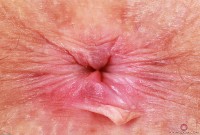 ATK hairy Jackie Hoff Set