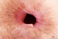 ATK hairy Jackie Hoff Set