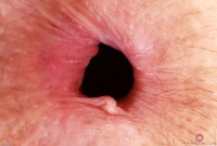 ATK hairy Jackie Hoff Set