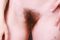 ATK hairy  in mature and hairy