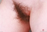 ATK hairy  in mature and hairy