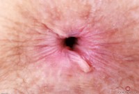 ATK hairy Jackie Hoff Set