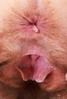 ATK hairy  in mature and hairy