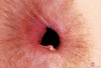 ATK hairy Jackie Hoff Set