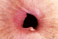 ATK hairy Jackie Hoff Set