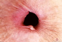 ATK hairy Jackie Hoff Set