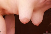 ATK hairy  in mature and hairy