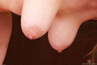 ATK hairy  in mature and hairy