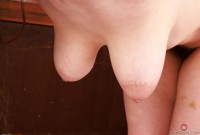 ATK hairy  in mature and hairy