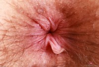 ATK hairy  in mature and hairy