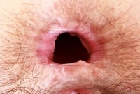 ATK hairy Jackie Hoff Set