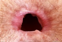 ATK hairy Jackie Hoff Set