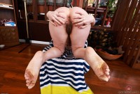 ATK hairy  in mature and hairy