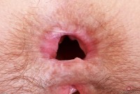 ATK hairy Jackie Hoff Set