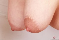 ATK hairy  in mature and hairy