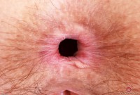 ATK hairy Jackie Hoff Set