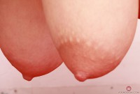 ATK hairy  in mature and hairy