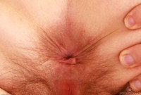 ATK hairy  in mature and hairy