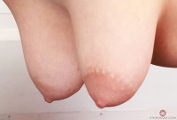 ATK hairy  in mature and hairy