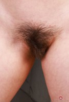 ATK hairy  in mature and hairy