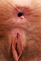 ATK hairy  in mature and hairy