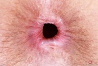 ATK hairy Jackie Hoff Set