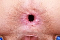 ATK hairy Jackie Hoff Set